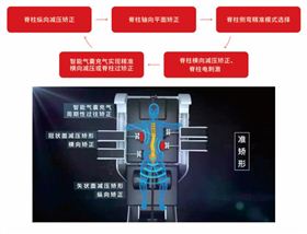 外星艙三維脊柱減壓矯形系統